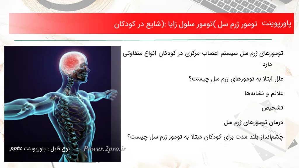 دانلود پاورپوینت تومور ژرم سل (تومور سلول زایا): شایع در کودکان - کد100395