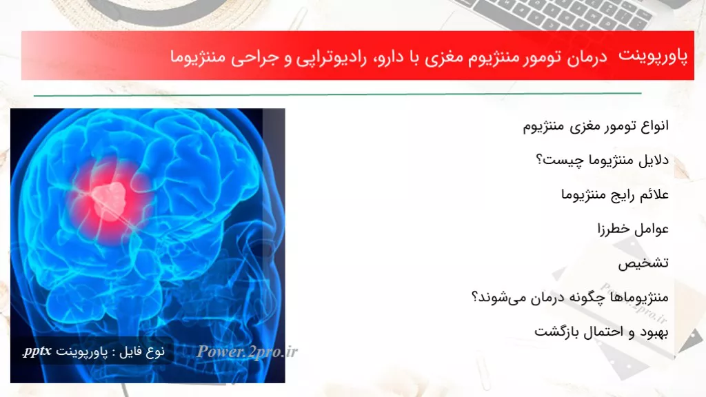 دانلود پاورپوینت درمان تومور مننژیوم مغزی با دارو، رادیوتراپی و جراحی مننژیوما - کد100397