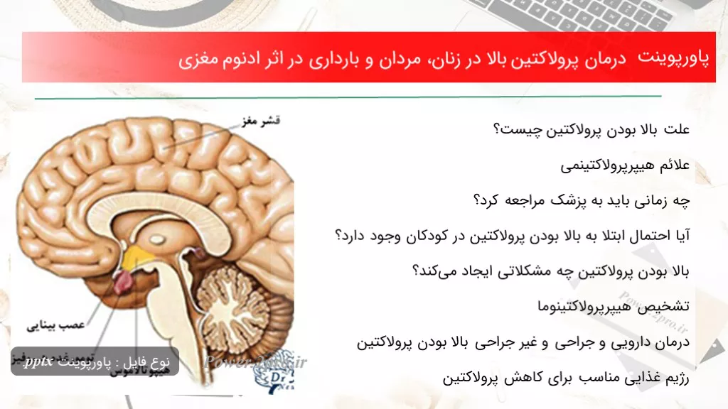 دانلود پاورپوینت درمان پرولاکتین بالا در زنان، مردان و بارداری در تاثیر ادنوم مغزی - کد100399