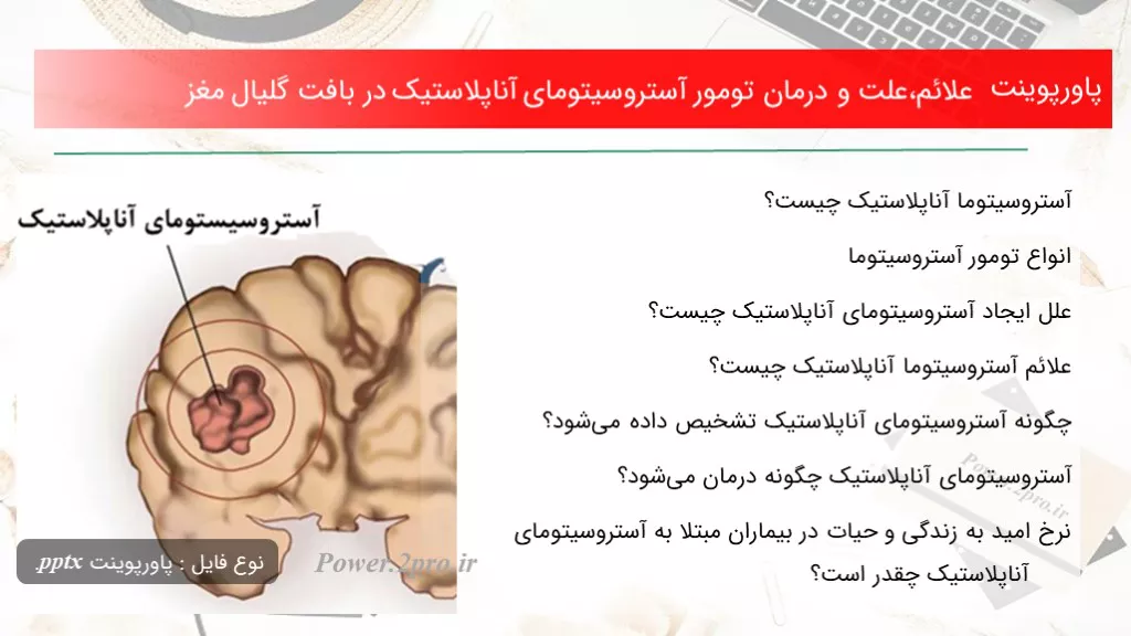 دانلود پاورپوینت علائم، چرایی و درمان تومور آستروسیتومای آناپلاستیک در بافت گلیال مغز - کد100400