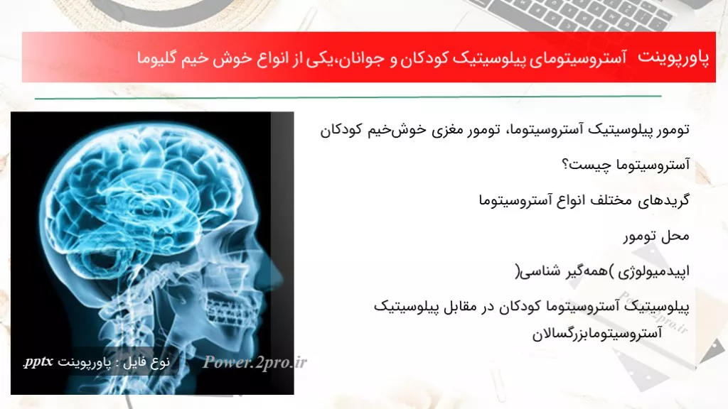 دانلود پاورپوینت آستروسیتومای پیلوسیتیک کودکان و جوانان،یکی از انواع خوش خیم گلیوما - کد100405