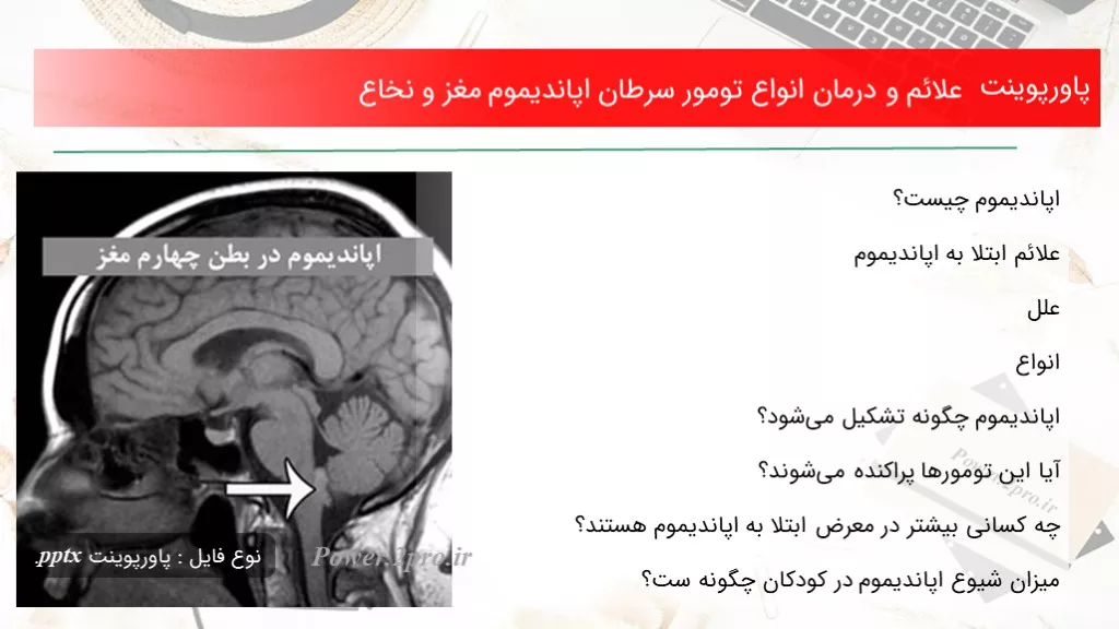 دانلود پاورپوینت علائم و درمان انواع تومور سرطان اپاندیموم مغز و نخاع - کد100410