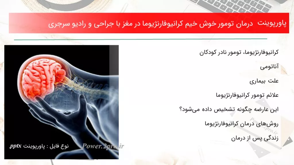 دانلود پاورپوینت درمان تومور خوش خیم کرانیوفارنژیوما در مغز با جراحی و رادیو سرجری - کد100423