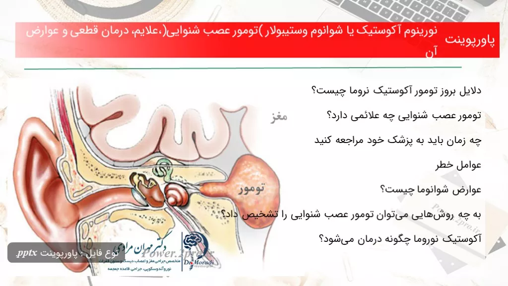 دانلود پاورپوینت نورینوم آکوستیک یا شوانوم وستیبولار (تومور عصب شنوایی)،علایم، درمان قطعی و ‌عوارض آن - کد100429