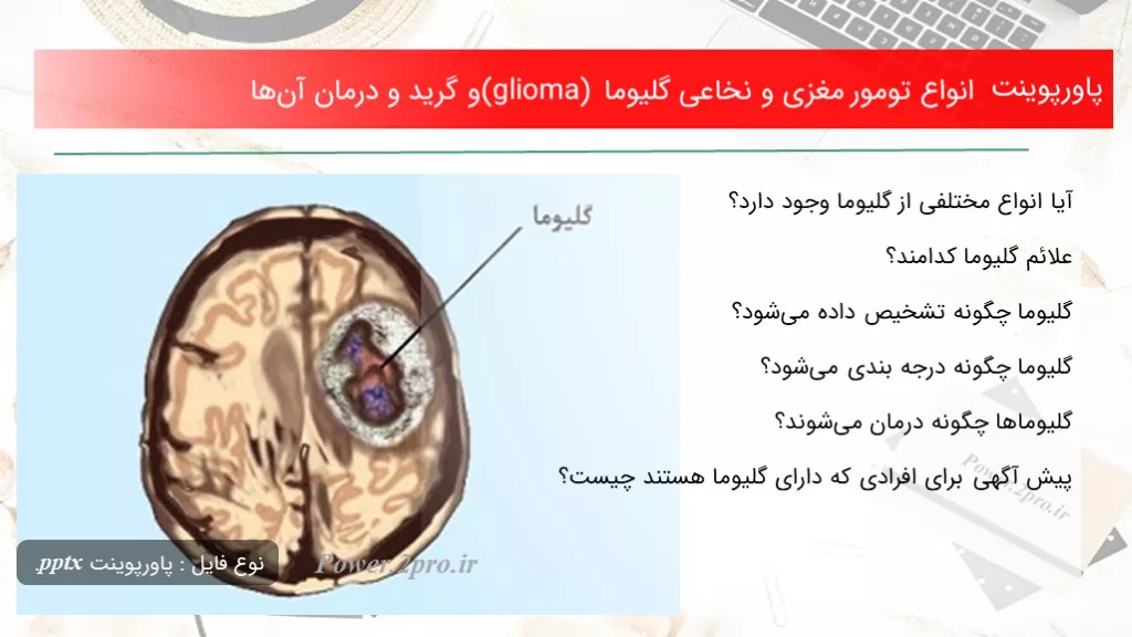 دانلود پاورپوینت انواع تومور مغزی و نخاعی گلیوما (glioma) و گرید و درمان آن‌ها - کد100434