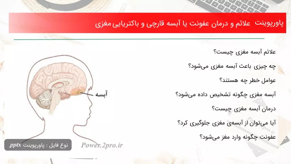 دانلود پاورپوینت علائم و درمان عفونت یا آبسه قارچی و باکتریایی مغزی - کد100439