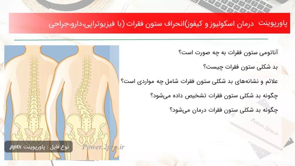 دانلود پاورپوینت درمان اسکولیوز و کیفوز(انحراف ستون فقرات) با فیزیوتراپی،دارو،جراحی - کد100446