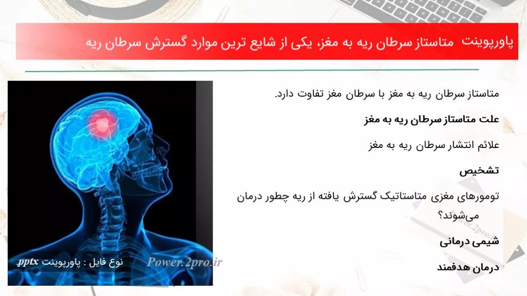 دانلود پاورپوینت متاستاز سرطان ریه به مغز، یکی از شایع ترین موارد گسترش سرطان ریه - کد100447