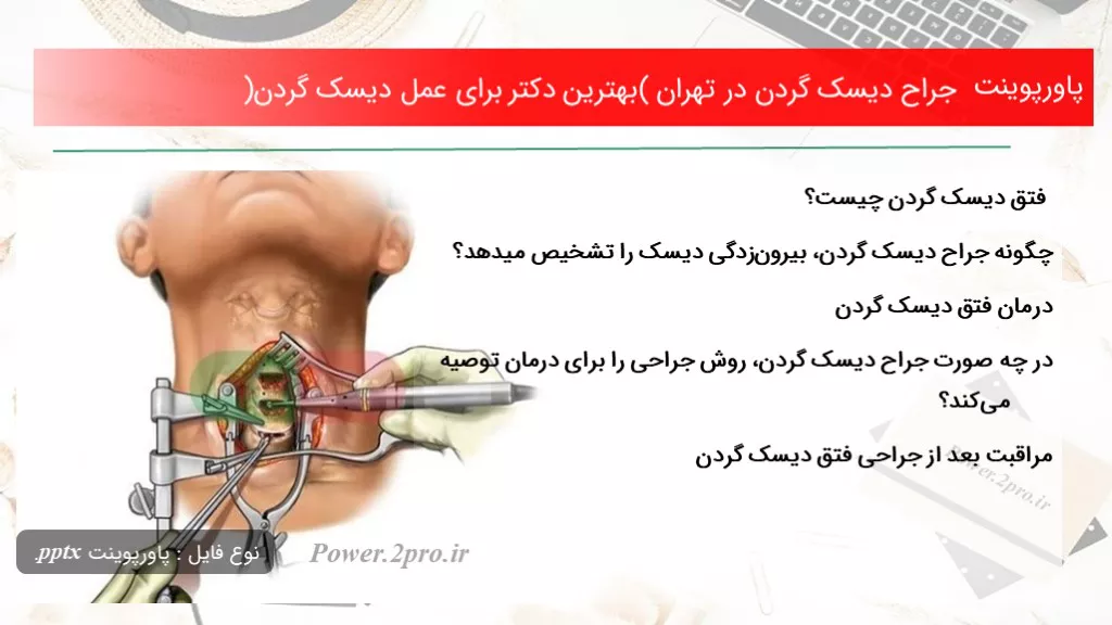 دانلود پاورپوینت جراح دیسک گردن در تهران (بهترین دکتر به منظور عمل دیسک گردن) - کد100458