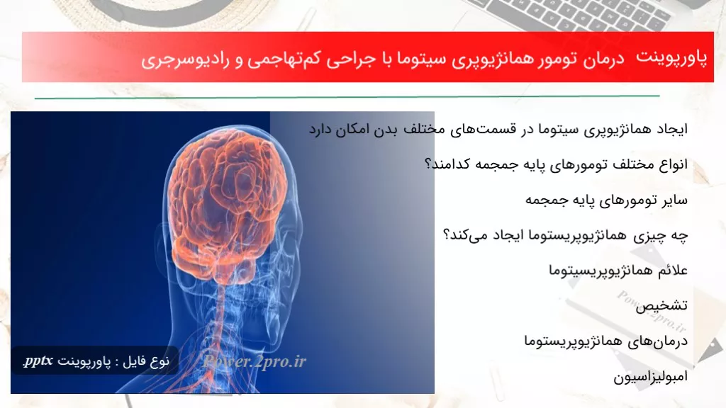 دانلود پاورپوینت درمان تومور همانژیوپری سیتوما با جراحی کم‌تهاجمی و رادیوسرجری - کد100465