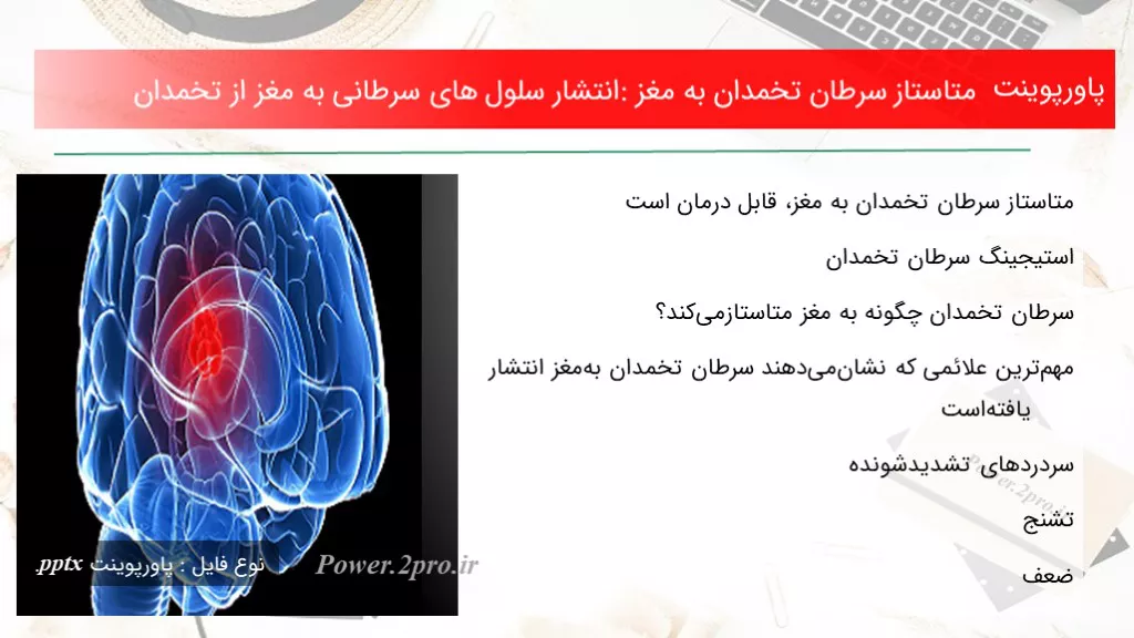 دانلود پاورپوینت متاستاز سرطان تخمدان به مغز: انتشار سلول های سرطانی به مغز از تخمدان - کد100473