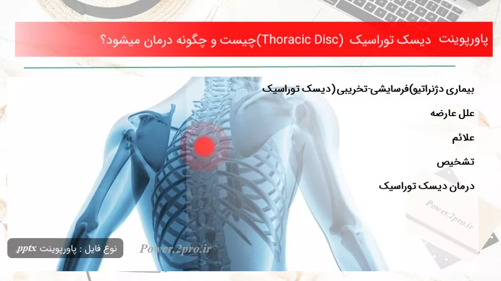 دانلود پاورپوینت دیسک توراسیک (Thoracic Disc) چه چیزی است و چطور درمان میشود؟ - کد100476