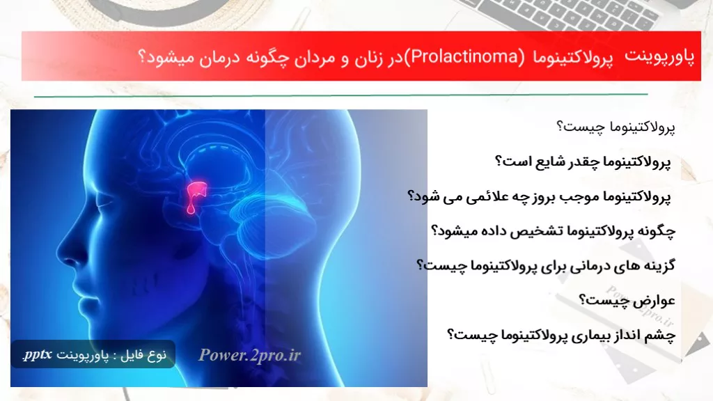 دانلود پاورپوینت پرولاکتینوما (Prolactinoma) در زنان و مردان چطور درمان میشود؟ - کد100481