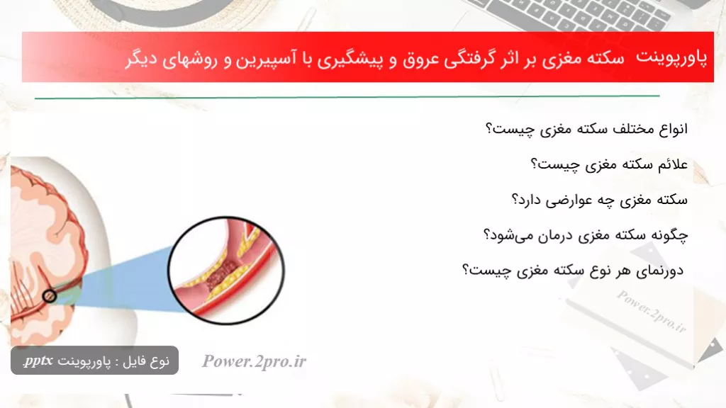 دانلود پاورپوینت سکته مغزی بر تاثیر گرفتگی عروق و پیشگیری با آسپیرین و روشهای دیگر - کد100484