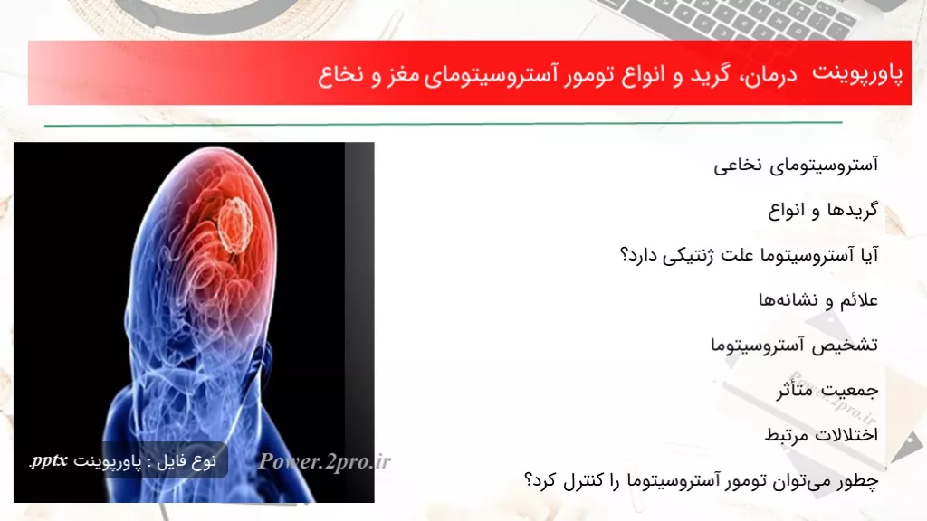 دانلود پاورپوینت درمان، گرید و انواع تومور آستروسیتومای مغز و نخاع - کد100488