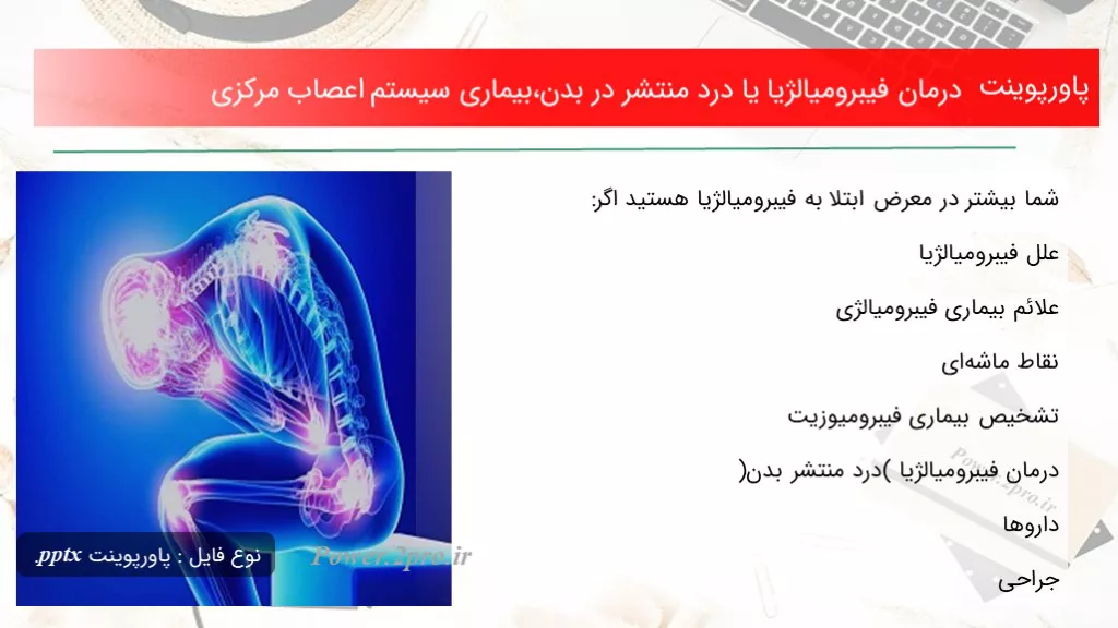 دانلود پاورپوینت درمان فیبرومیالژیا یا درد منتشر در بدن،بیماری سیستم اعصاب مرکزی - کد100489