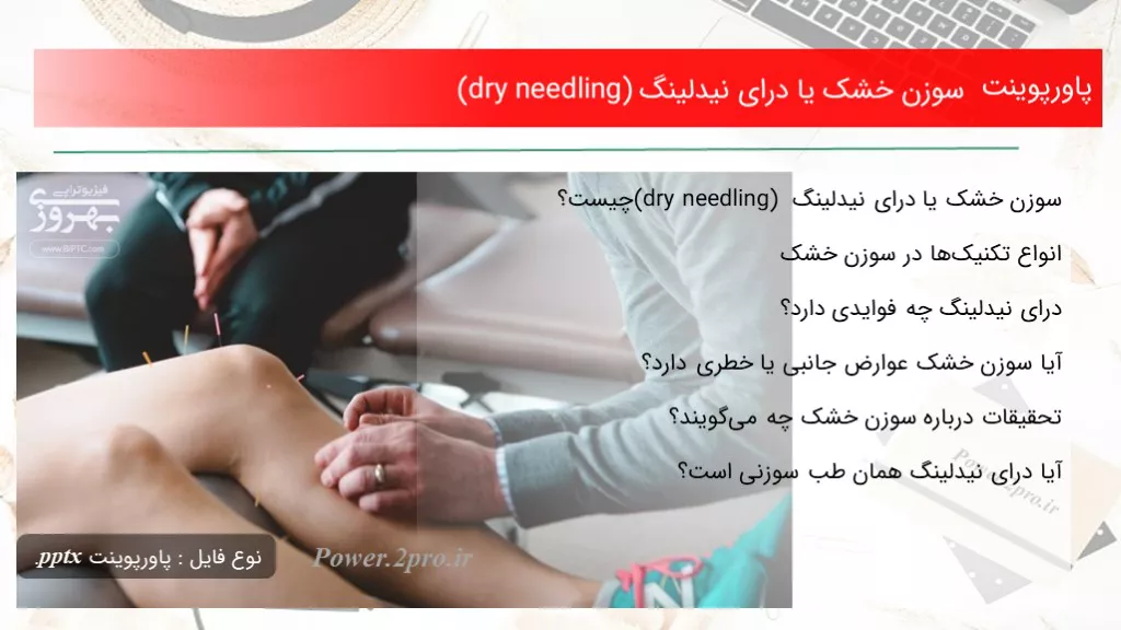 دانلود پاورپوینت سوزن خشک یا درای نیدلینگ (dry needling) - کد100575