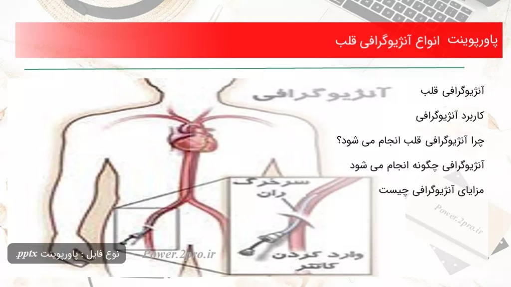 دانلود پاورپوینت انواع آنژیوگرافی قلب - کد101186