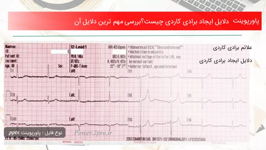 دانلود پاورپوینت دلایل ایجاد برادی کاردی چه چیزی است ؟بررسی مهم ترین دلایل آن - کد101195