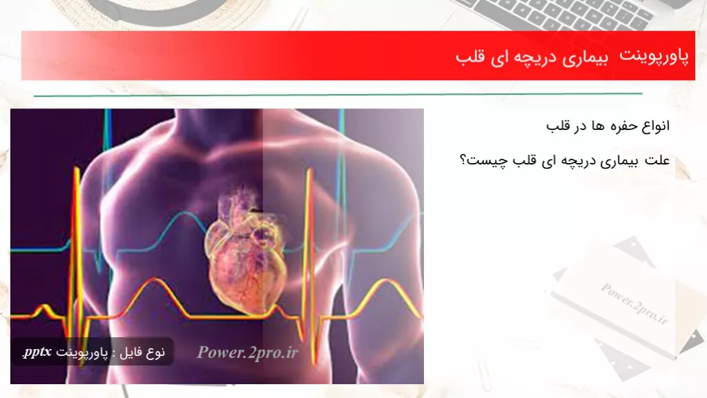 دانلود پاورپوینت بیماری دریچه ای قلب - کد101209
