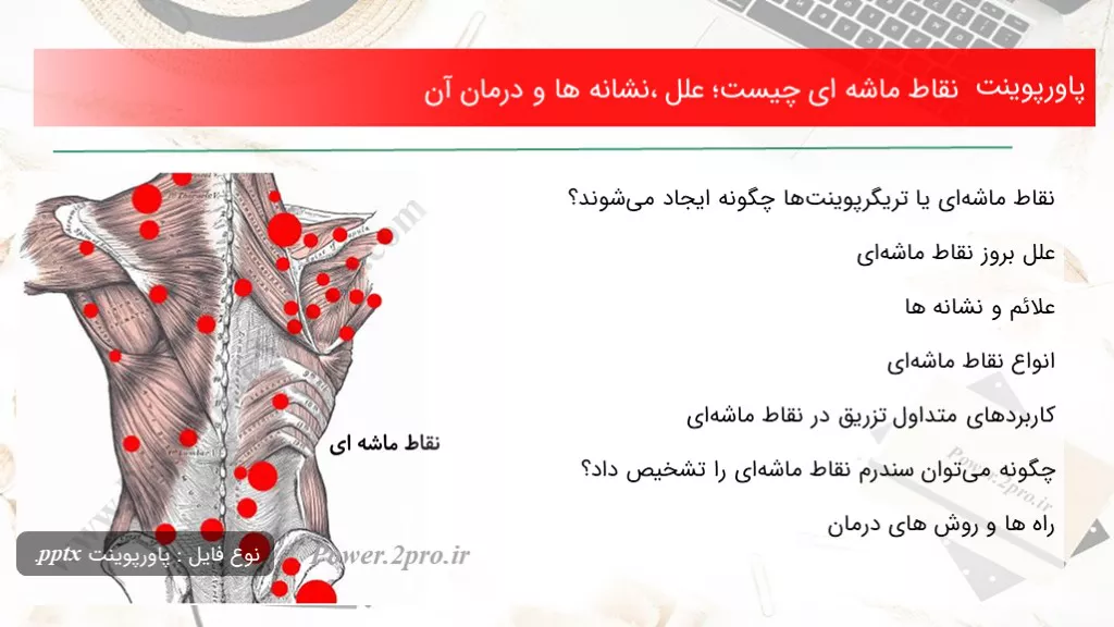 دانلود پاورپوینت نقاط ماشه ای چه چیزی است ؛ علل ،نشانه ها و درمان آن - کد101242