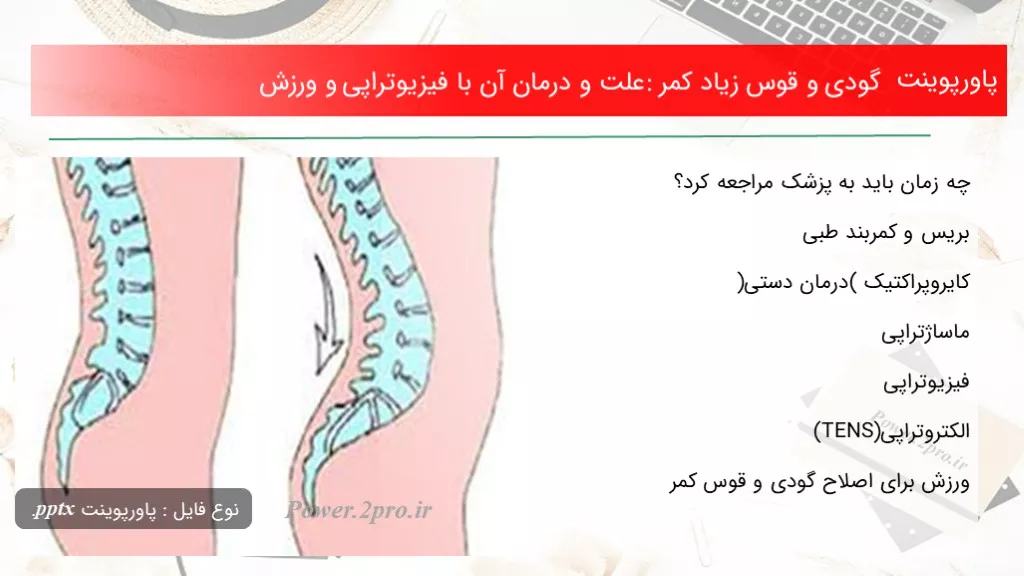 دانلود پاورپوینت گودی و قوس زیاد کمر: چرایی و درمان آن با فیزیوتراپی و ورزش - کد101279