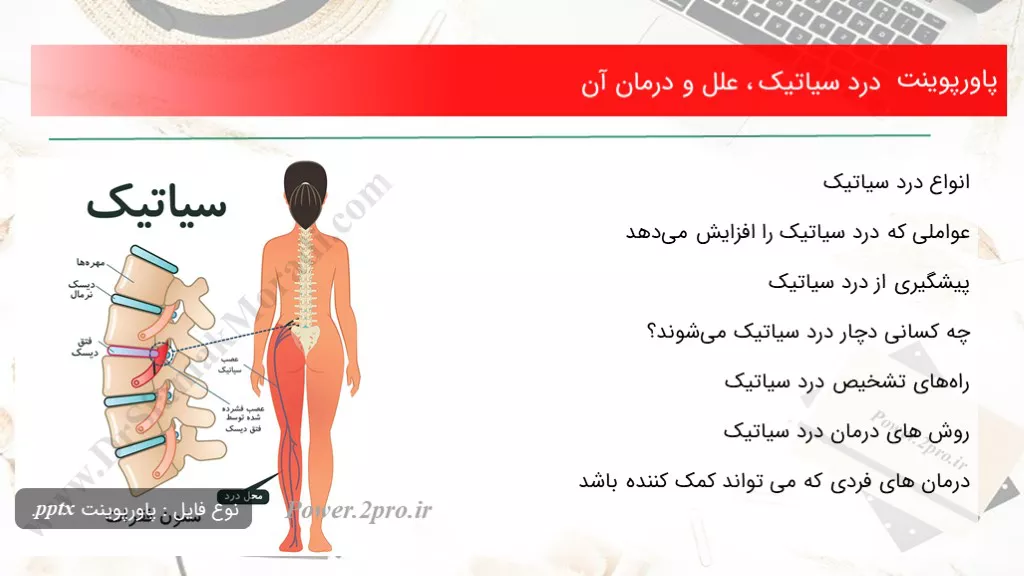 دانلود پاورپوینت درد سیاتیک ، علل و درمان آن - کد101306