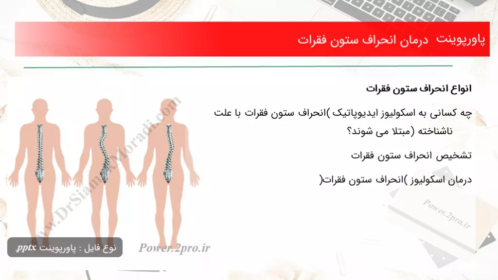 دانلود پاورپوینت درمان انحراف ستون فقرات - کد101330