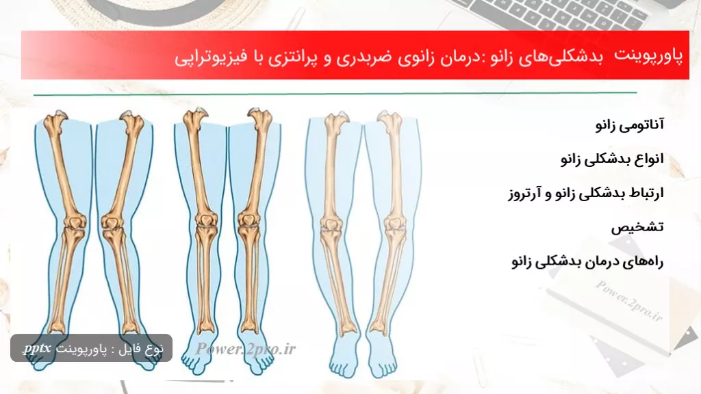 دانلود پاورپوینت بدشکلی‌های زانو: درمان زانوی ضربدری و پرانتزی با فیزیوتراپی - کد101351