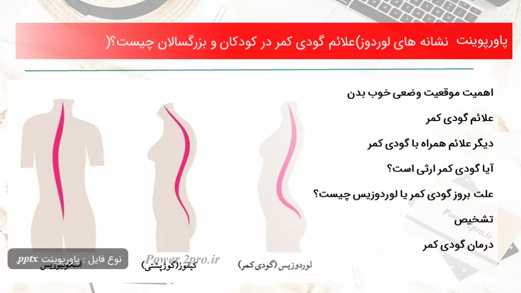 دانلود پاورپوینت نشانه های لوردوز(علائم گودی کمر در کودکان و بزرگسالان چه چیزی است ؟) - کد101358