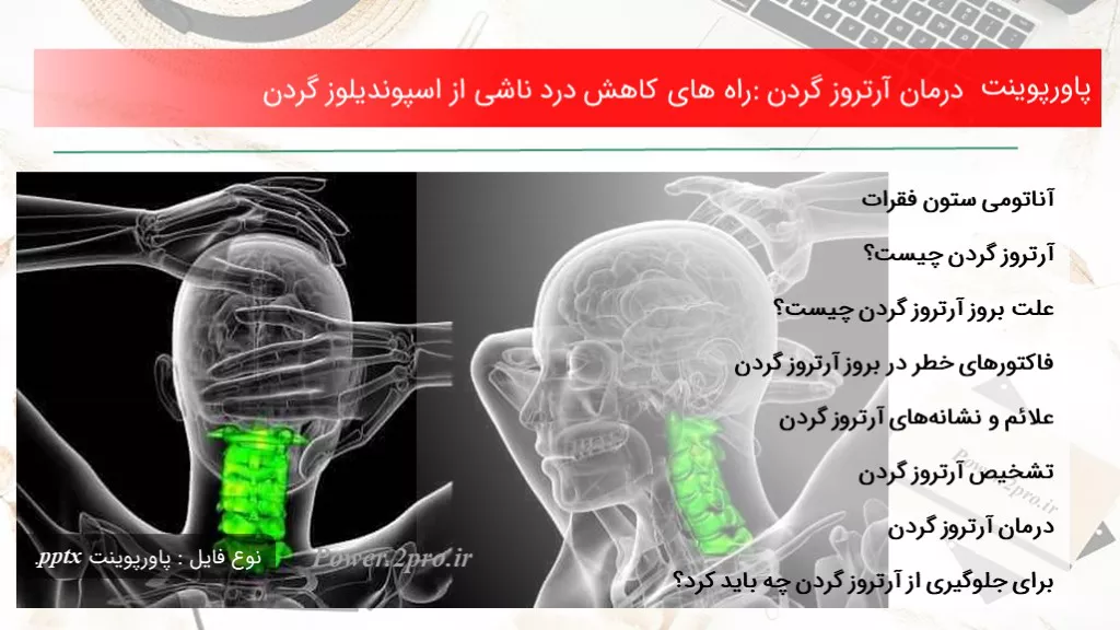 دانلود پاورپوینت درمان آرتروز گردن: راه های افت درد ناشی از اسپوندیلوز گردن - کد101373