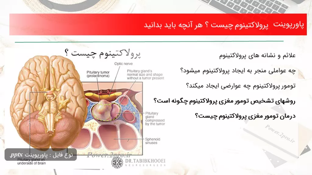 دانلود پاورپوینت پرولاکتینوم چه چیزی است ؟ هر آنچه باید بدانید - کد101394