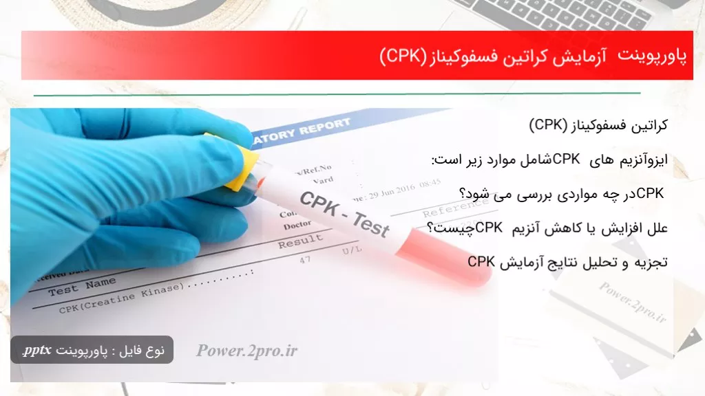 دانلود پاورپوینت آزمایش کراتین فسفوکیناز (CPK) - کد101463