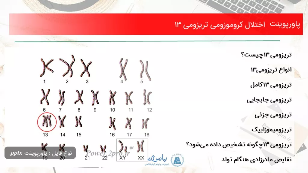 دانلود پاورپوینت اختلال کروموزومی تریزومی ۱۳ - کد101464