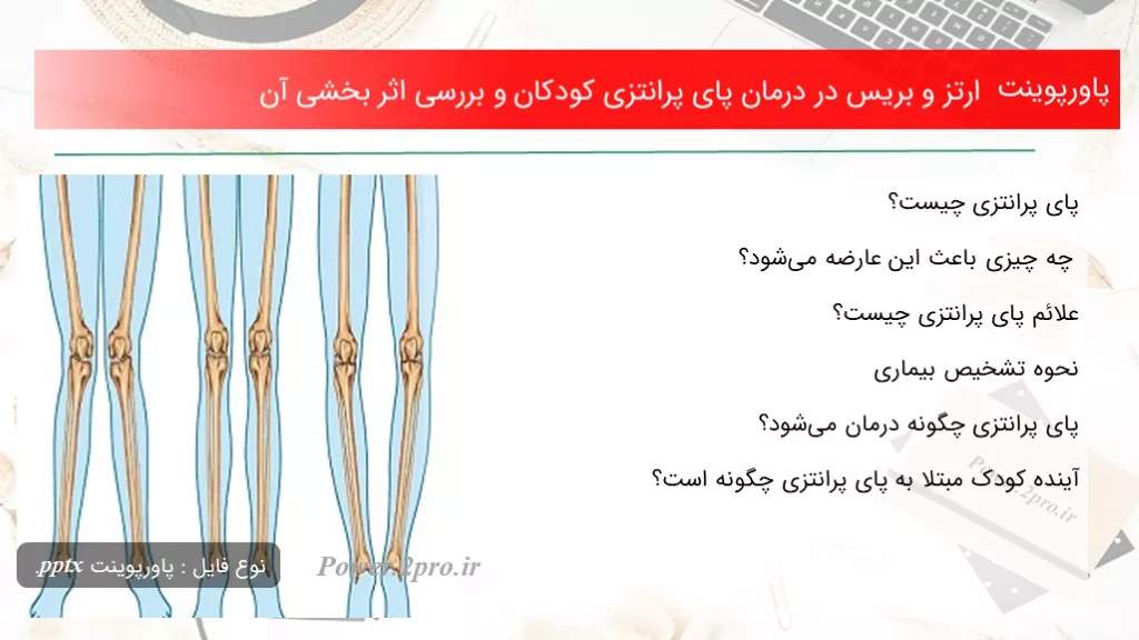 دانلود پاورپوینت ارتز و بریس در درمان پای پرانتزی کودکان و بررسی تاثیر بخشی آن - کد101510