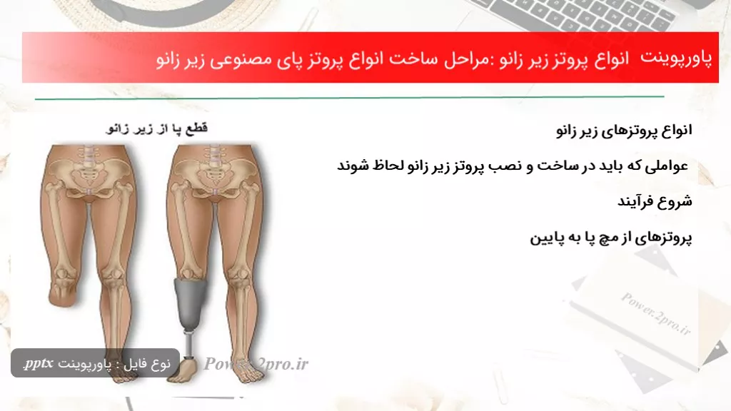 دانلود پاورپوینت انواع پروتز زیر زانو: مراحل ساخت انواع پروتز پای مصنوعی زیر زانو - کد101530