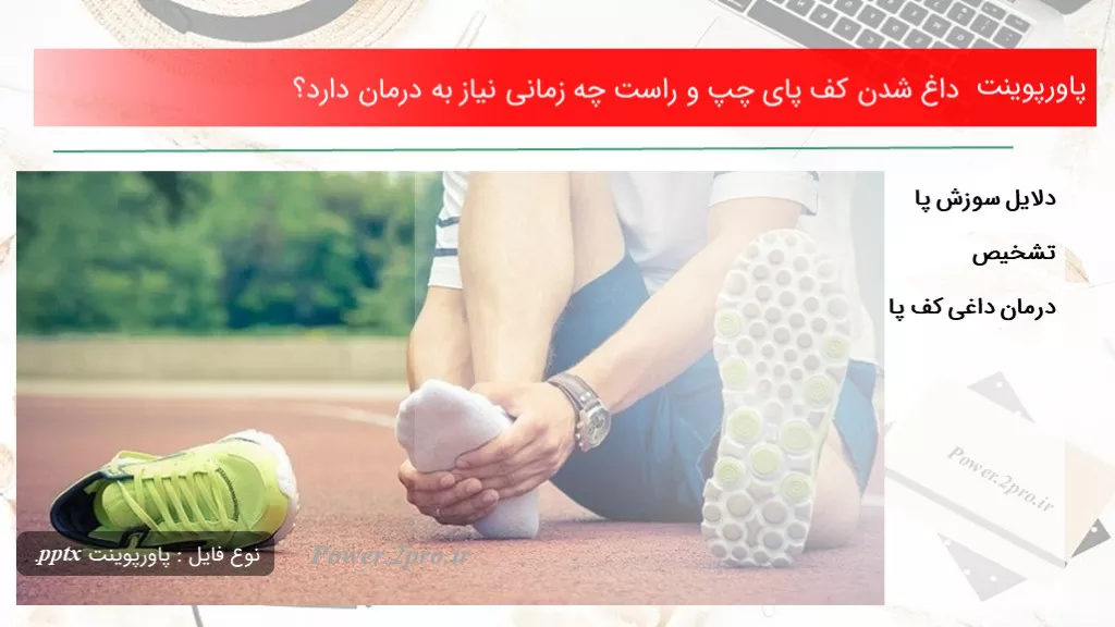 دانلود پاورپوینت داغ شدن کف پای چپ و راست چه زمانی نیاز به درمان دارد؟ - کد101557