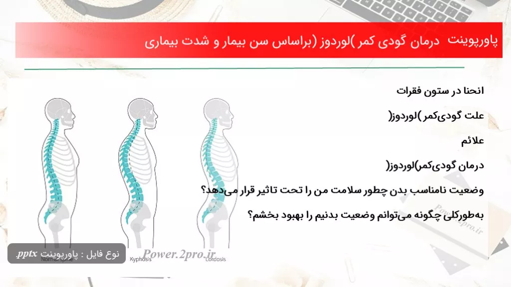 دانلود پاورپوینت درمان گودی کمر (لوردوز) برپایه سن بیمار و شدت بیماری - کد101588