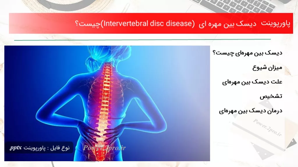 دانلود پاورپوینت دیسک میان مهره ای (Intervertebral disc disease) چه چیزی است ؟ - کد101589