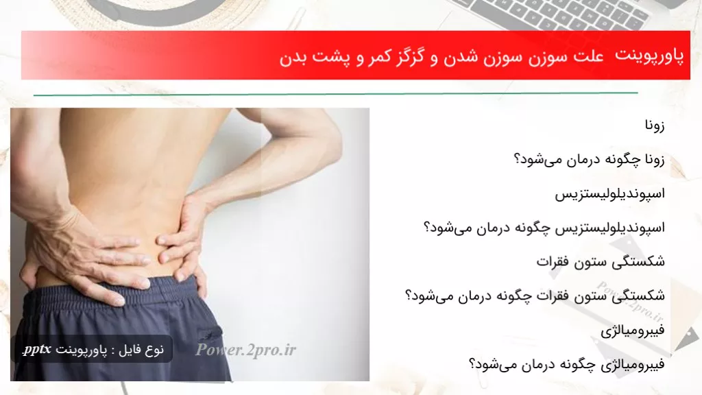 دانلود پاورپوینت چرایی سوزن سوزن شدن و گزگز کمر و پشت بدن - کد101603