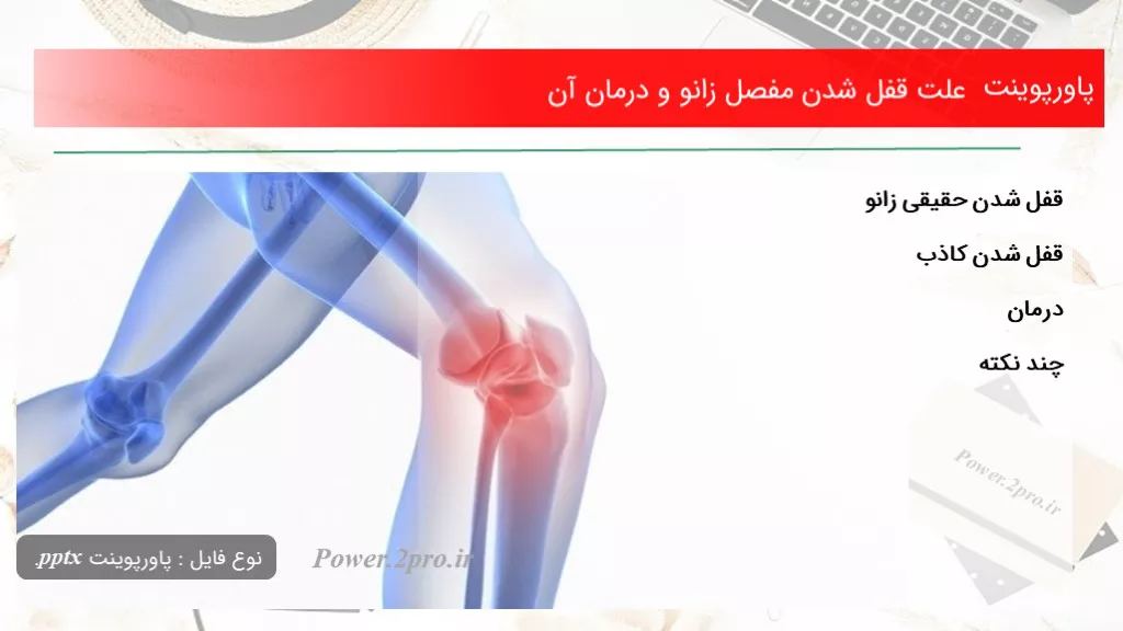 دانلود پاورپوینت چرایی قفل شدن مفصل زانو و درمان آن - کد101704