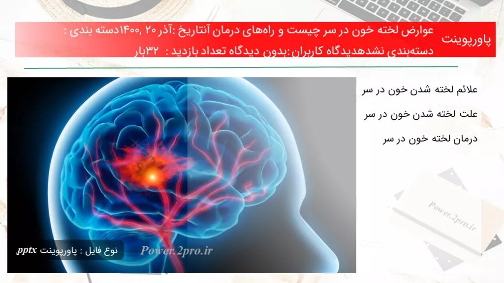 دانلود پاورپوینت عوارض لخته خون در سر چه چیزی است و راه‌های درمان آنتاریخ: آذر ۲۰, ۱۴۰۰دسته بندی: دسته‌بندی نشدهدیدگاه کاربران: بدون دیدگاه تعداد بازدید: 32 بار - کد101721