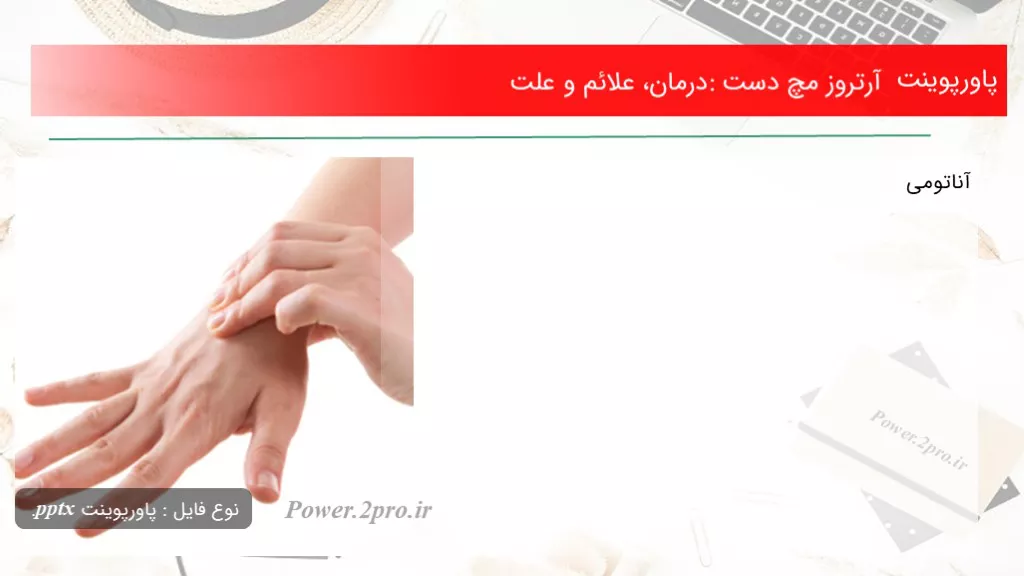 دانلود پاورپوینت آرتروز مچ دست: درمان، علائم و چرایی - کد101725