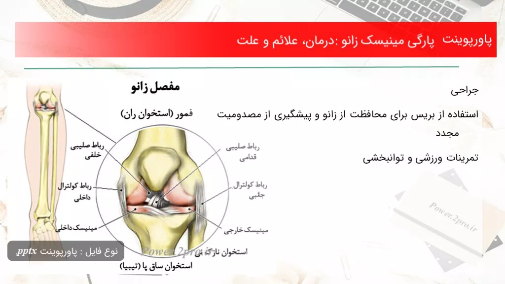 دانلود پاورپوینت پارگی مینیسک زانو: درمان، علائم و چرایی - کد101766