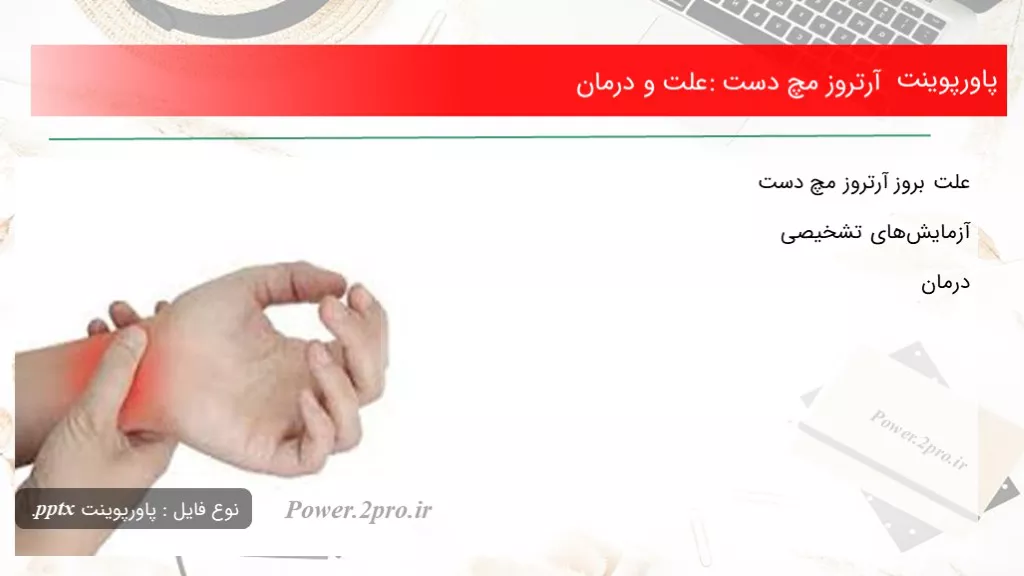 دانلود پاورپوینت آرتروز مچ دست: چرایی و درمان - کد101845