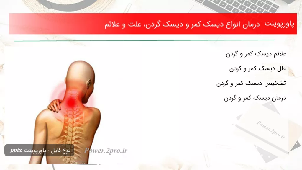 دانلود پاورپوینت درمان انواع دیسک کمر و دیسک گردن، چرایی و علائم - کد101872