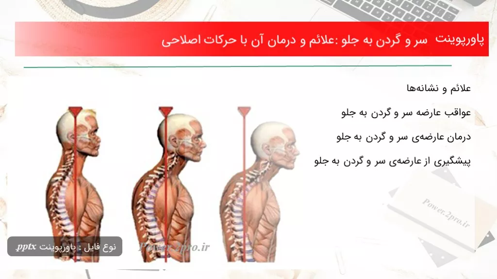 دانلود پاورپوینت سر و گردن به جلو: علائم و درمان آن با حرکات اصلاحی - کد101897