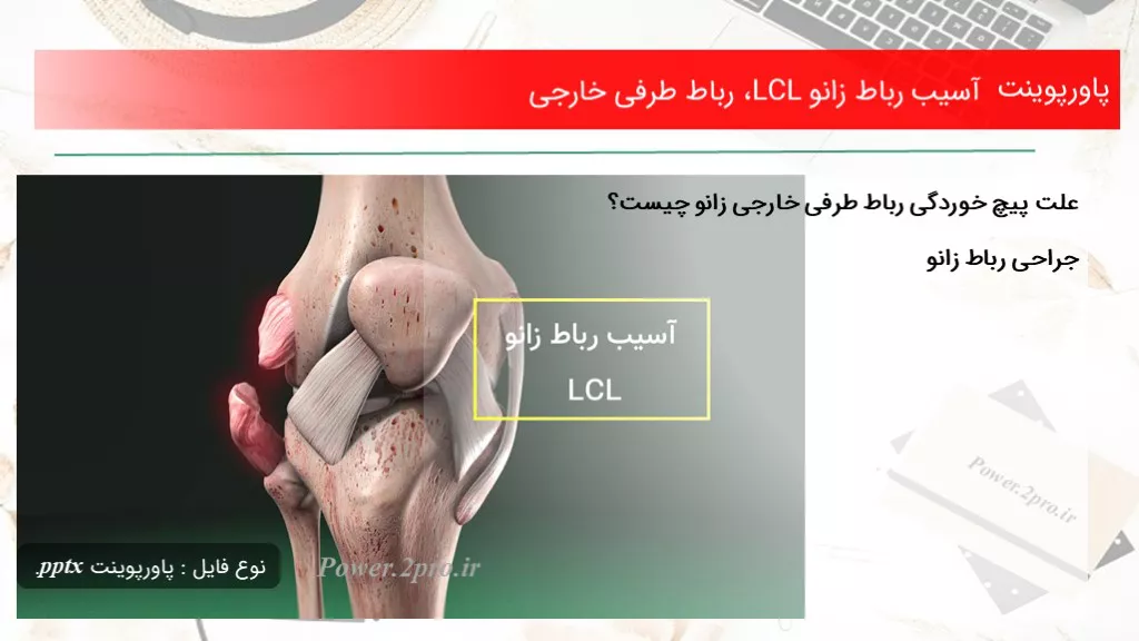 دانلود پاورپوینت آسیب رباط زانو LCL، رباط طرفی خارجی - کد101951