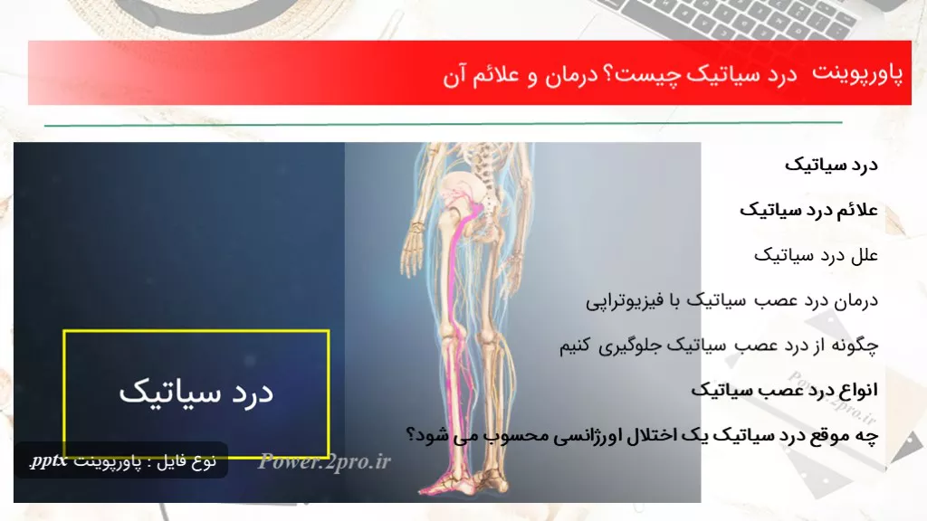 دانلود پاورپوینت درد سیاتیک چه چیزی است ؟ درمان و علائم آن - کد102030