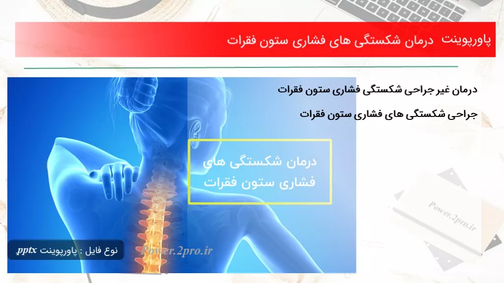 دانلود پاورپوینت درمان شکستگی های فشاری ستون فقرات - کد102054